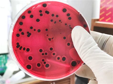 Pentingnya Pengujian Laboratorium dalam Menemukan Bakteri Penyebab Penyakit